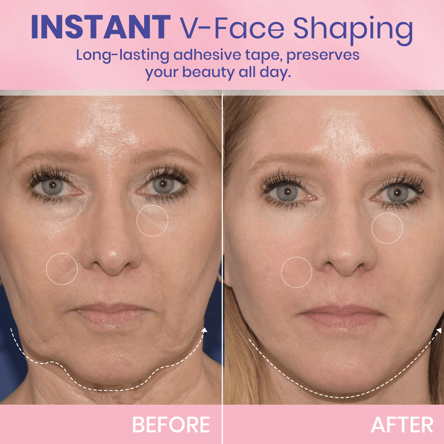 ✨ BBOJI™ Invisible Face Lift Tape 💖 Instantly Sculpt Your Jawline & Hide Double Chin