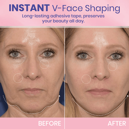 ✨ BBOJI™ Invisible Face Lift Tape 💖 Instantly Sculpt Your Jawline & Hide Double Chin