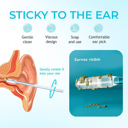 🏆Flash Sale⚡ 50K+ SOLD!-Ear cleanner Sticky Pick
